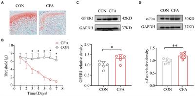 The chronification mechanism of orofacial inflammatory pain: Facilitation by GPER1 and microglia in the rostral ventral medulla